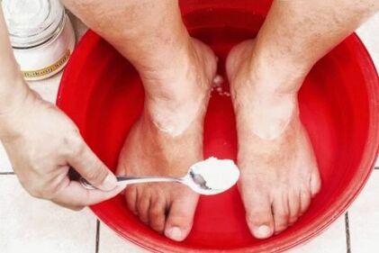 Léčba houby na palci nohy