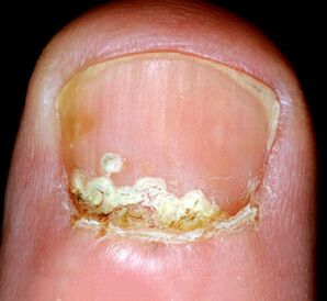 Příznaky a příznaky nemoci