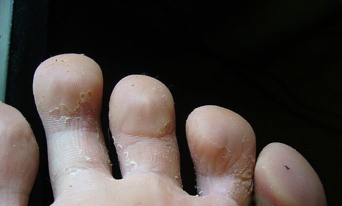 počáteční fáze houby