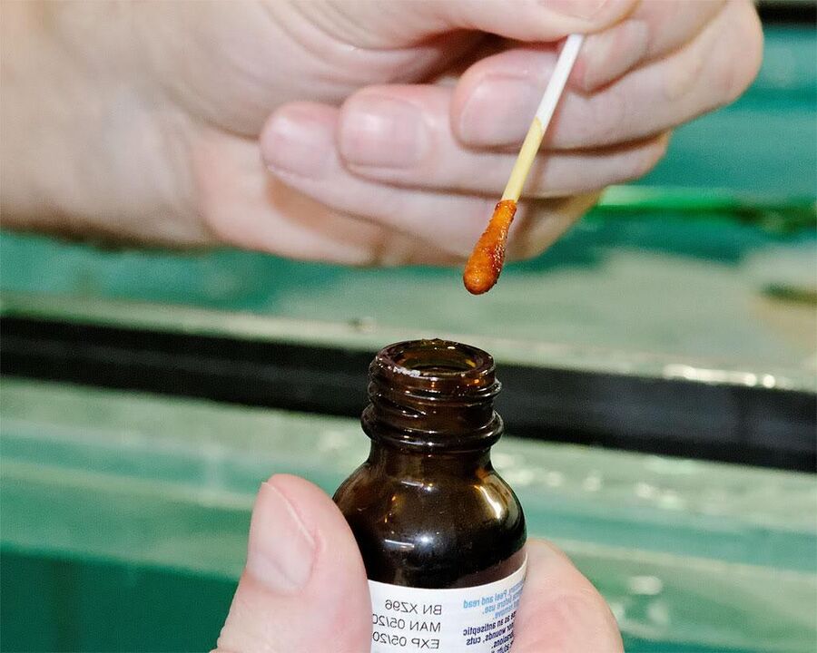 Nanesením směsi jódu a celandinové šťávy na nehty na nohou se zbavíte plísní
